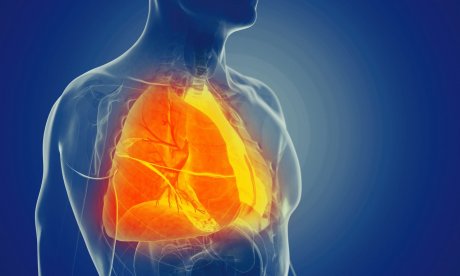 Πνευμονοκονίαση από εισπνοή σκόνης: Συμπτώματα και επιπλοκές υγείας