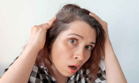 Πρόωρο γκριζάρισμα στα μαλλιά: Πού οφείλεται – Αντιστρέφεται;