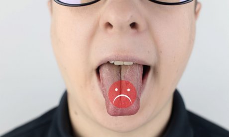7 τρόποι για να υποχωρήσει το κάψιμο στη γλώσσα