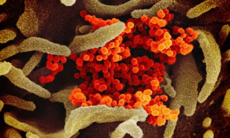 Ελπίδες για θεραπεία του HIV: Νέα τεχνολογία φανερώνει τον κρυμμένο στα κύτταρα ιό