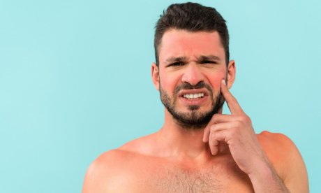 Ηλιακό έγκαυμα: Ποια είναι η καλύτερη θεραπεία σύμφωνα με δερματολόγους;