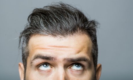 Πιτυρίδα φρυδιών: Τι την προκαλεί και πώς θα απαλλαγείτε