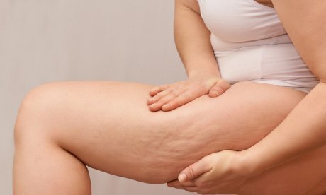 Λιποίδημα: Τι είναι και πώς αντιμετωπίζεται