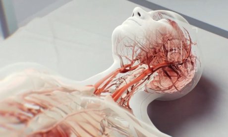 Πρόληψη εγκεφαλικού: Μικρορομπότ κολυμπούν στα αγγεία και διαλύουν θρόμβους αίματος [video]