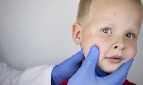 Ποια ανίατη νόσος ήταν σε ύφεση, αλλά εξαπλώνεται ξανά παγκοσμίως