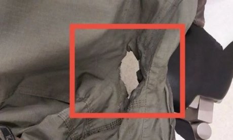 ΑΠΘ: «Ήταν δολοφονική επίθεση» - Άνοιξε τρύπα σε στολή αστυνομικού από μολότοφ