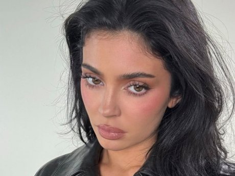 Δοκίμασες lip filler; Η δερματολόγος μοιράζεται μαζί μας όσα δεν πρέπει να κάνεις μετά