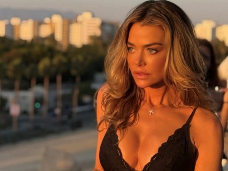 Το facelift της Denise Richards είναι η πιο ειλικρινής beauty αποκάλυψη στο Χόλυγουντ