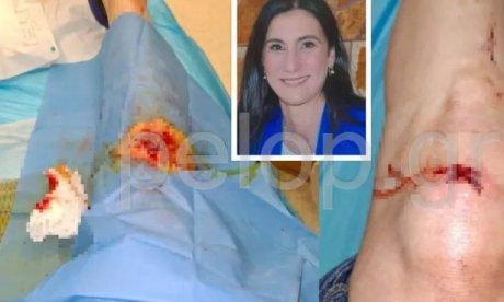Πάτρα: «Αποφάσισα να δω το ηλιοβασίλεμα, εμφανίστηκαν 50 Ρομά», λέει η Ανδριάνα Φωτακοπούλου